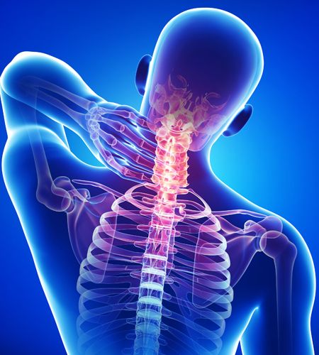 درمان خانگی گردن درد و گرفتگی عضلات گردن | ساده ترین روش ها برای درمان گردن درد