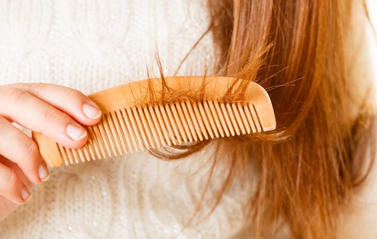 درمان ریزش مو در مردها